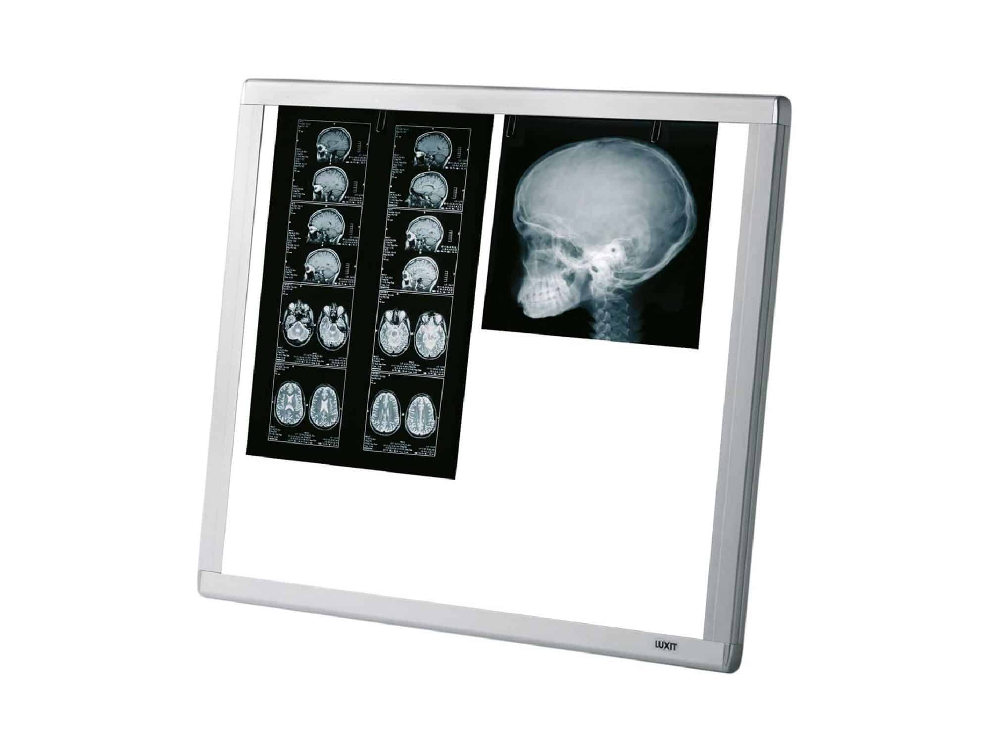 Tables chauffantes réanimation néonatale