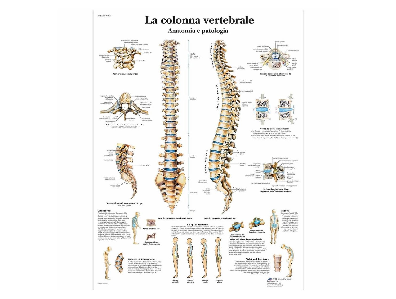 Vertèbres lombaires 3 pièces