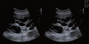 Echographe Vinno X35-Diagnostic