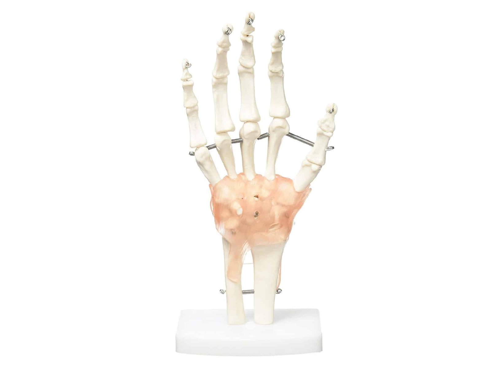 Articulation de la main avec ligaments