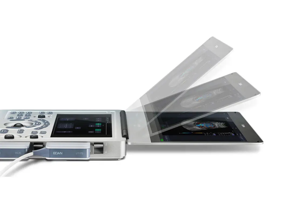 Échographe portable Acclarix AX3