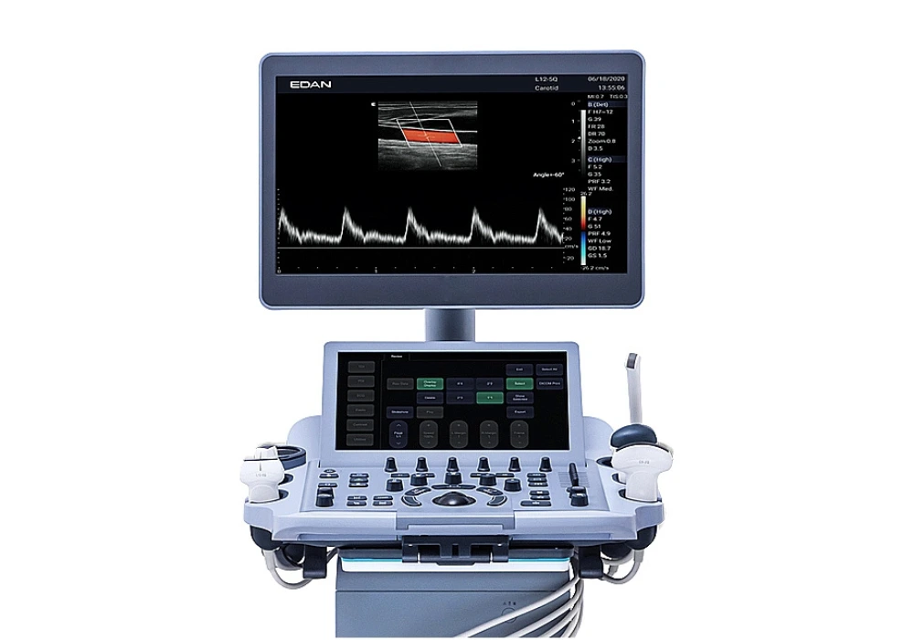 echographe LX3