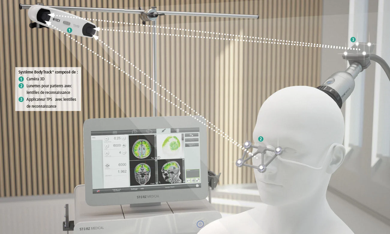 Stimulation transcrânienne par impulsions (TPS)